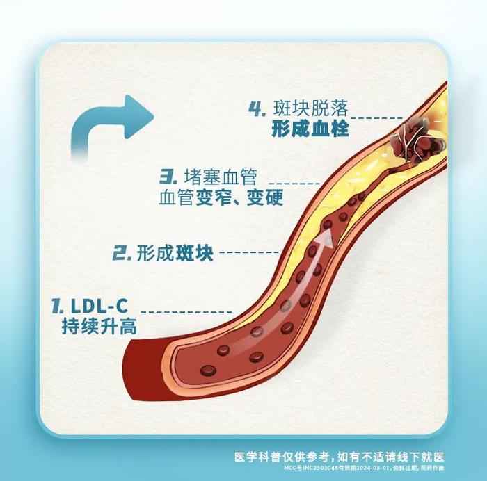 血栓是怎么来的？可以逆转吗？