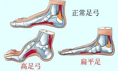 薄薄一片，支撑有力，稳健行走