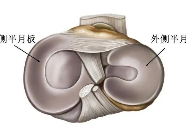 膝关节疼痛常见原因，您属于哪一种？丨贤医健康说