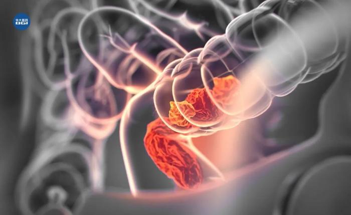 青年肠癌发病率翻倍？和老年肠癌有何不同？Nature子刊最新研究揭秘
