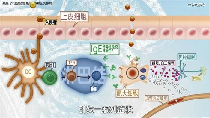 过敏性鼻炎，正在无差别扫射大城市打工人