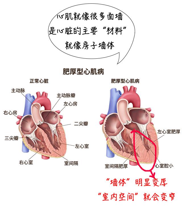 17岁男生踢足球猝然倒地，整个家族的“心事”藏不住了