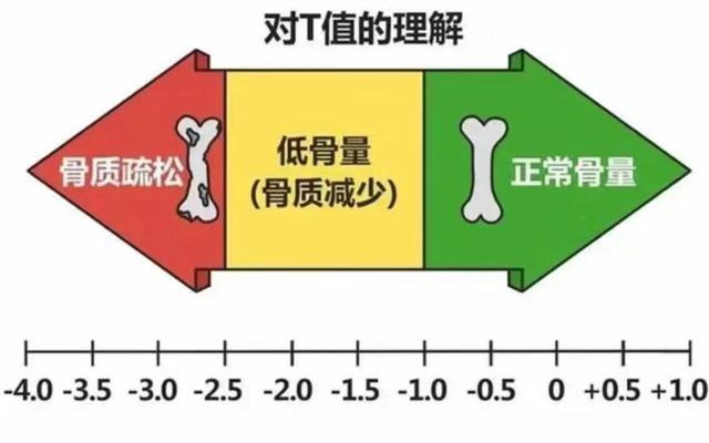 识别骨质疏松症，石湖荡镇社区卫生服务中心可以做这项检查→