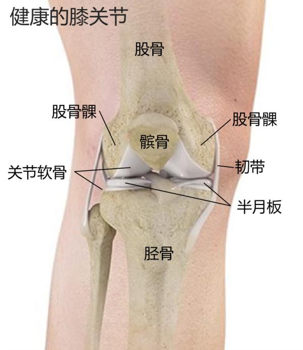 膝关节为何会损伤？换了人工关节啥感觉？一文了解→