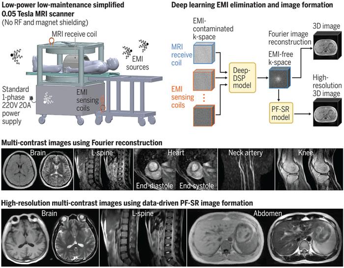AI赋能降低MRI成本！Science | 我国科学家开发出低成本的超低场核磁共振成像技术，高端影像普及不再是梦