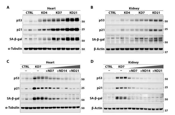 给你个不坚持的理由！Science Advances最新研究: 长期生酮饮食会诱导细胞衰老，而间歇性生酮饮食能阻止细胞老化积累