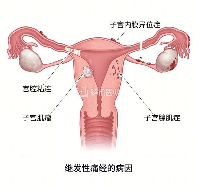 痛经，到底能不能吃止痛药？