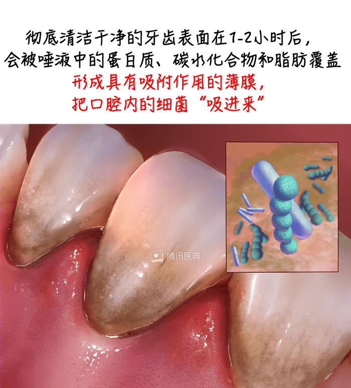 经常口臭的人，一般都逃不过这 2 个原因