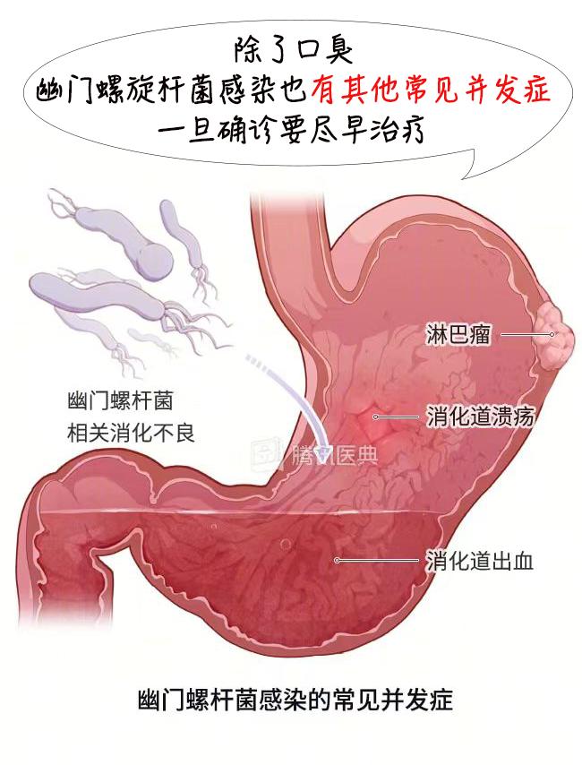 经常口臭的人，一般都逃不过这 2 个原因