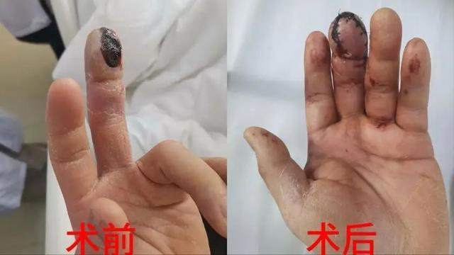 不吃死虾，不吃虾头，不要生食……小龙虾的正确吃法来了→