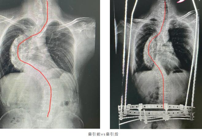 福建协和医院这位医生，厉害了！