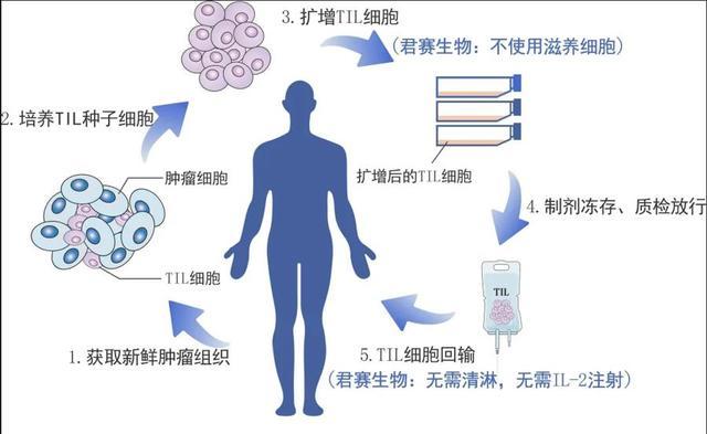 癌症TIL疗法进入临床试验，给晚期实体肿瘤患者带来希望