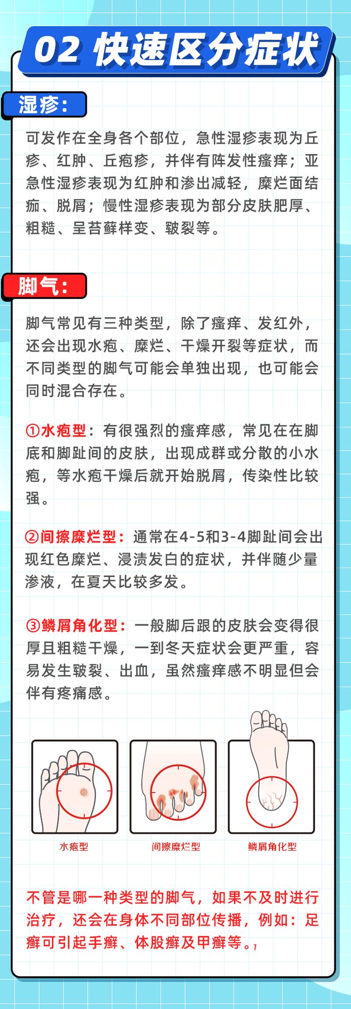 脚气or湿疹，分不清就治疗，小心适得其反！