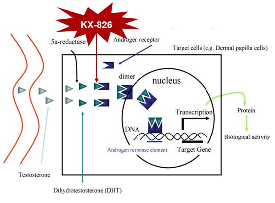 EADV聚焦雄激素性脱发进展，探索KX-826临床研究成果