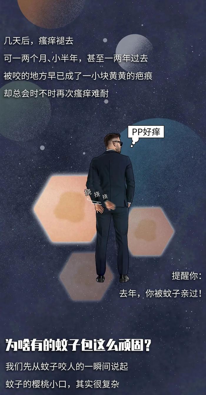 被蚊子咬了，再痒也别挠！教你3招马上止痒