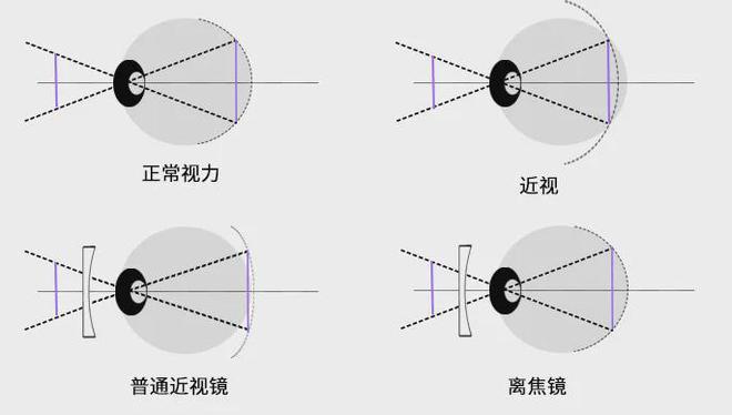 有了端侧AI，手机屏幕也能护眼了 | 荣耀赵明@MWC上海