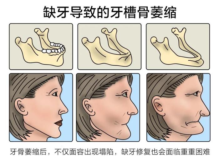 上海免费发放，报名时间明确：牙齿健康再加码 | 专题