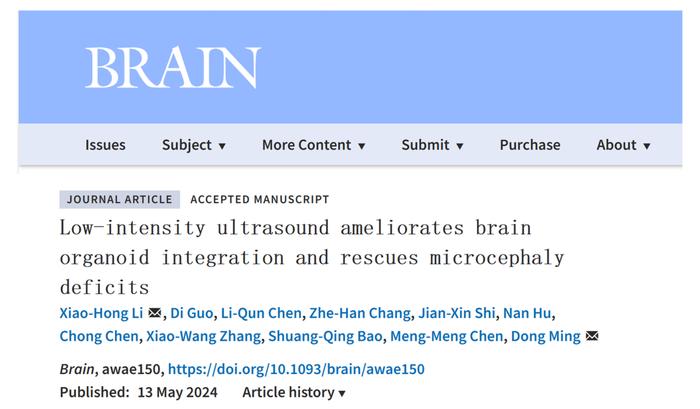 全球首个“人脑”控制机器人，天津大学新成果登上顶刊《Brain》
