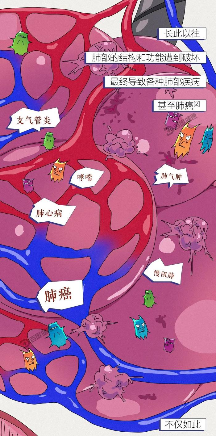 这个杀死47岁中年男性的凶手，就在你我身边...