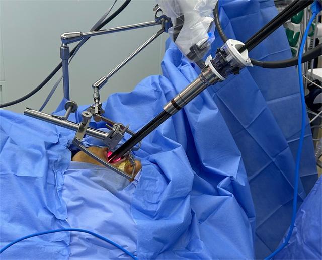 瑞金医院耳鼻喉科完成国内首个咽喉良恶性肿瘤经口单孔机器人手术真实世界研究