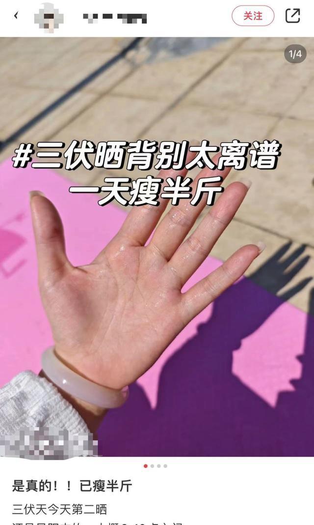 热闻|多人跟风！三伏天晒背能“0成本减肥”？医生提醒：不要盲目晒背