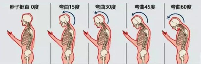 颈椎难受和性生活有关？看完这条长知识了！