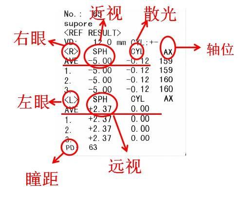 别让暑假成为孩子近视的加速器！正确配镜攻略在此！