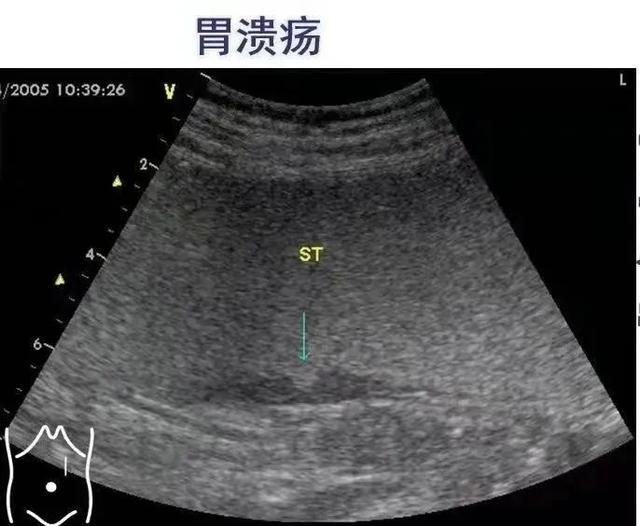 严谨细致，用最美“声波”护航生命健康丨发现好医生