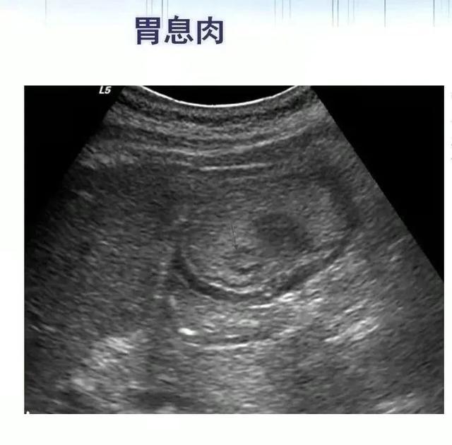 严谨细致，用最美“声波”护航生命健康丨发现好医生