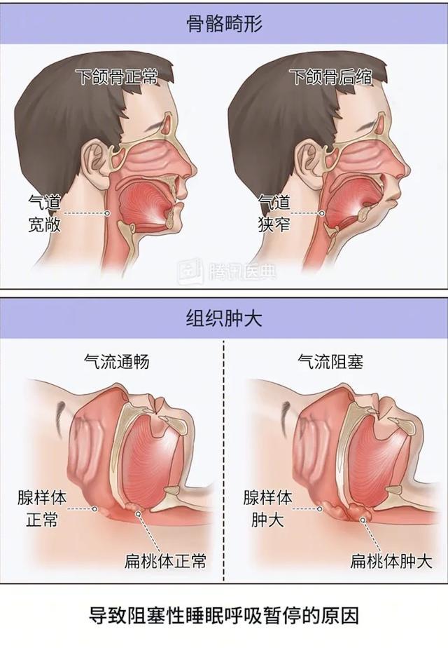 这种病小时候没治好，长大了更难治！