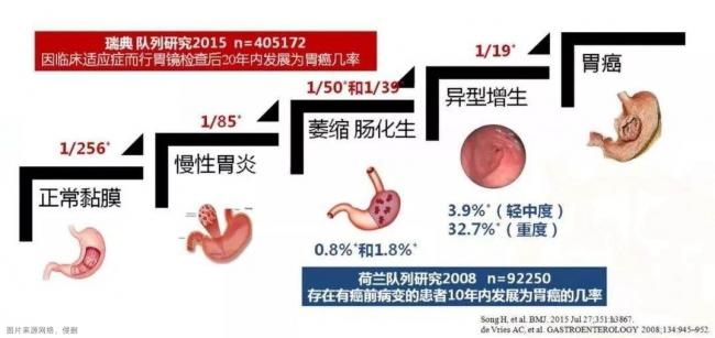 觉念愈心堂一站式治疗萎缩性胃炎，让胃癌止步于慢性胃炎阶段