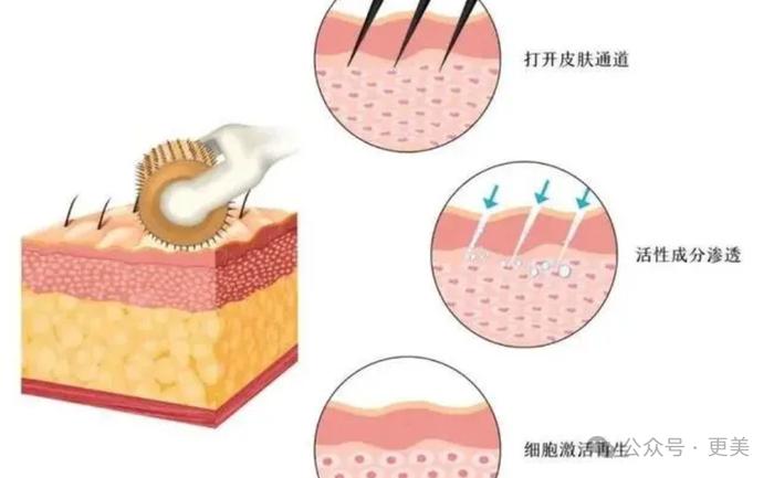 除了割双眼皮+垫鼻子的吴艳妮，其他奥运选手都整了啥？