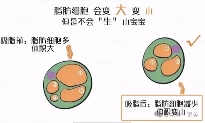 为王思聪生下女儿后，黄一鸣紧急吸脂、重回少女腰！