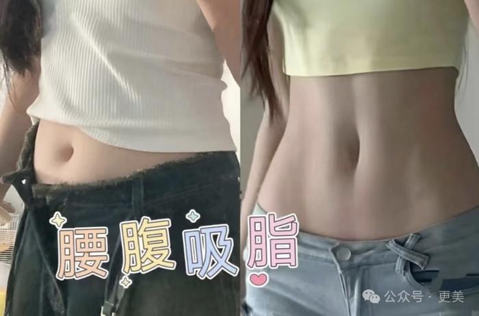 为王思聪生下女儿后，黄一鸣紧急吸脂、重回少女腰！