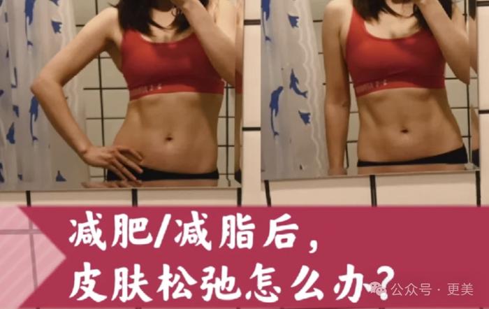 为王思聪生下女儿后，黄一鸣紧急吸脂、重回少女腰！