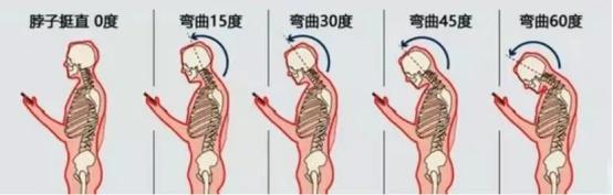 年轻人跑医院“吊脖子”？快来测测你有颈椎问题吗→