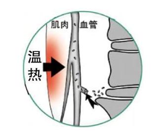 使用可喜安电位温热治疗仪注意说明书提示和适用范围