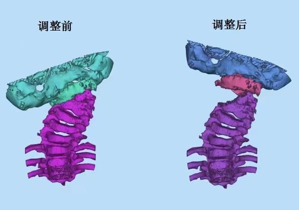 “百发百中”！外科手术里的导航技术……