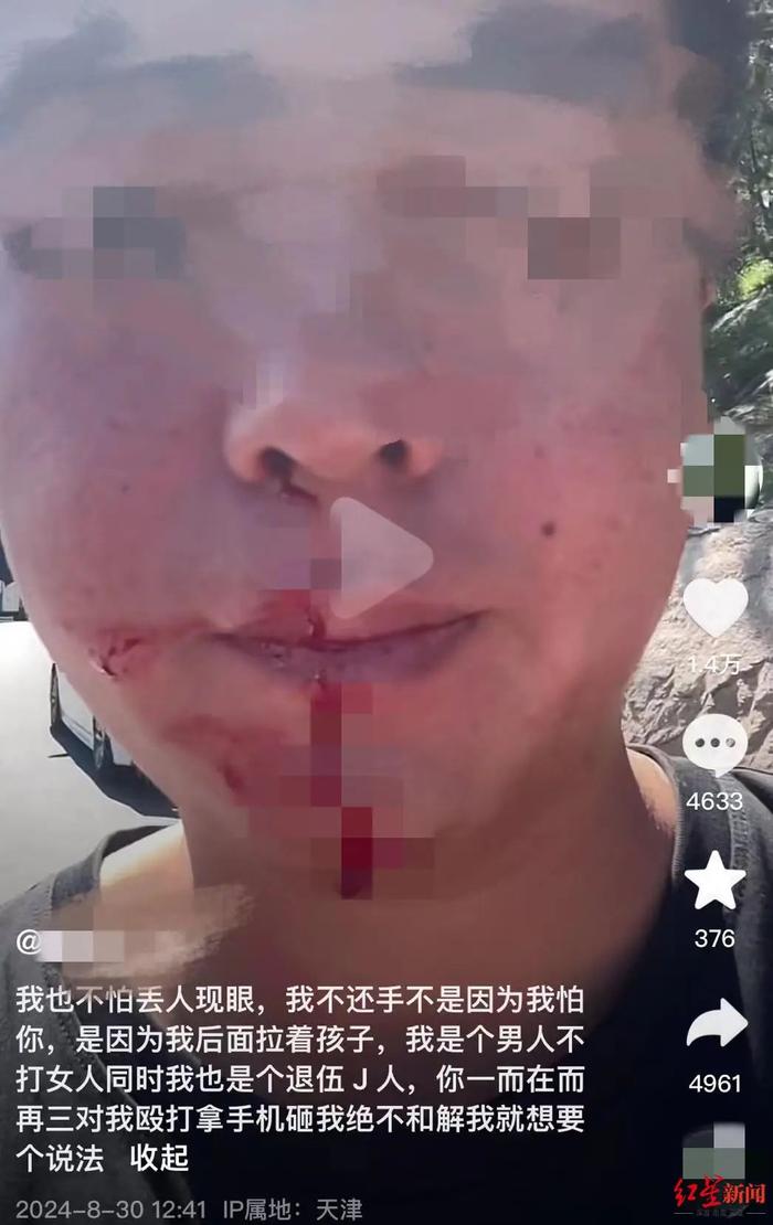 被逆行“路虎女”连扇十几个耳光，男子发声：绝不和解！遭殴打到底能不能还手，律师分析→