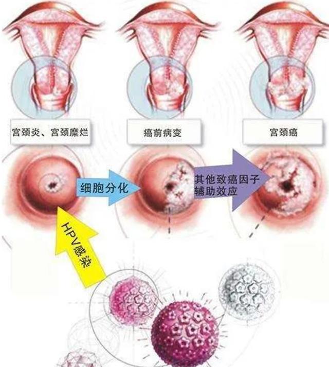 9月起，区中心医院新开宫颈外阴疾病门诊→