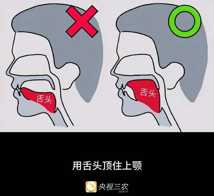 冲上热搜！大脑也会“结冰”？医生紧急提醒→