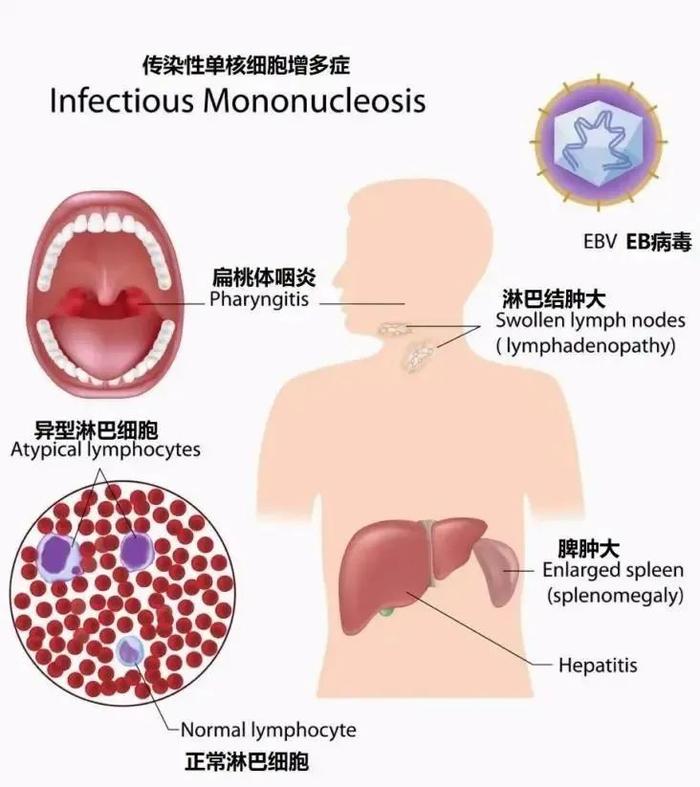 【健康科普】警惕这种病毒！河北省儿童医院最新提醒→