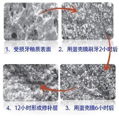 牙齿上裹层“膜”，竟能让牙齿再生，烂牙变好牙！家家都有这材料