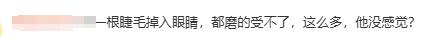 医生回应女子眼角掉出74根眼睫毛