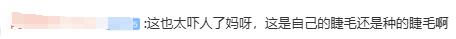 医生回应女子眼角掉出74根眼睫毛