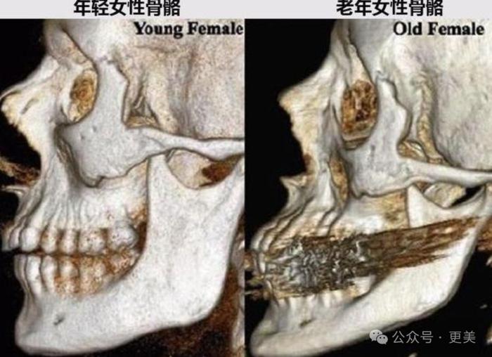 都一刀切过下颌角，为啥她削了14年没垮过？