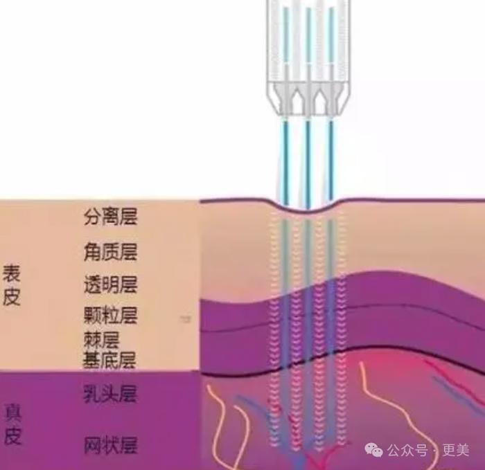 都一刀切过下颌角，为啥她削了14年没垮过？