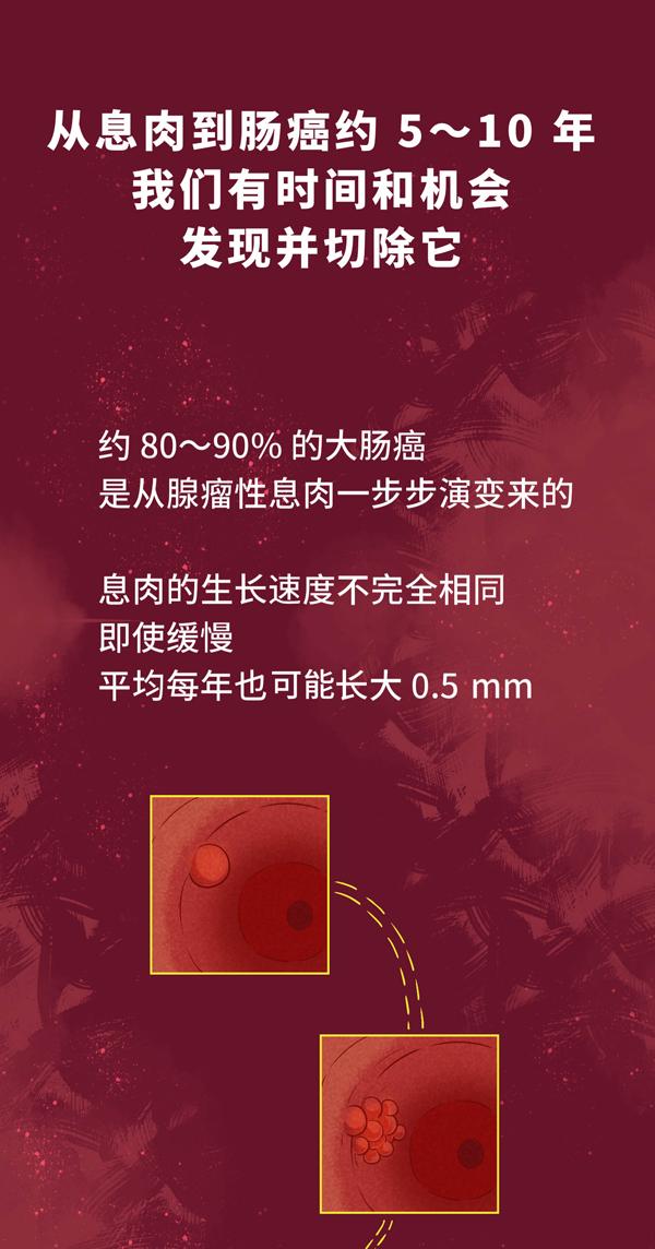 发现就是中晚期的肠癌，一个方法可以避免