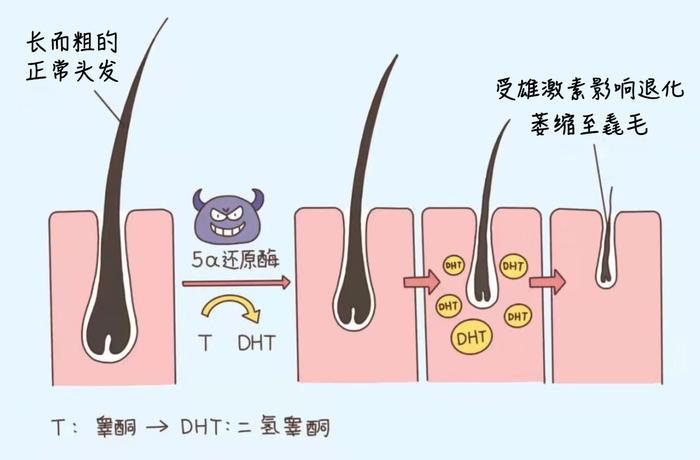 这种饮料，越喝头越秃，你可能每天都在喝