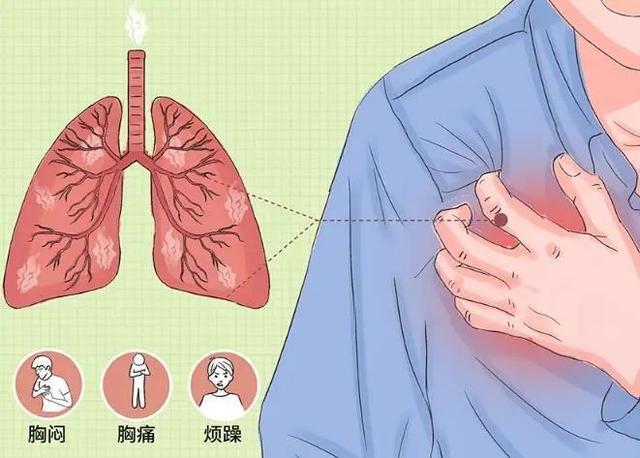 男子排便时太用力，竟把肺憋“炸”了！医生提醒：排便切忌用力过猛，多种风险后果严重→